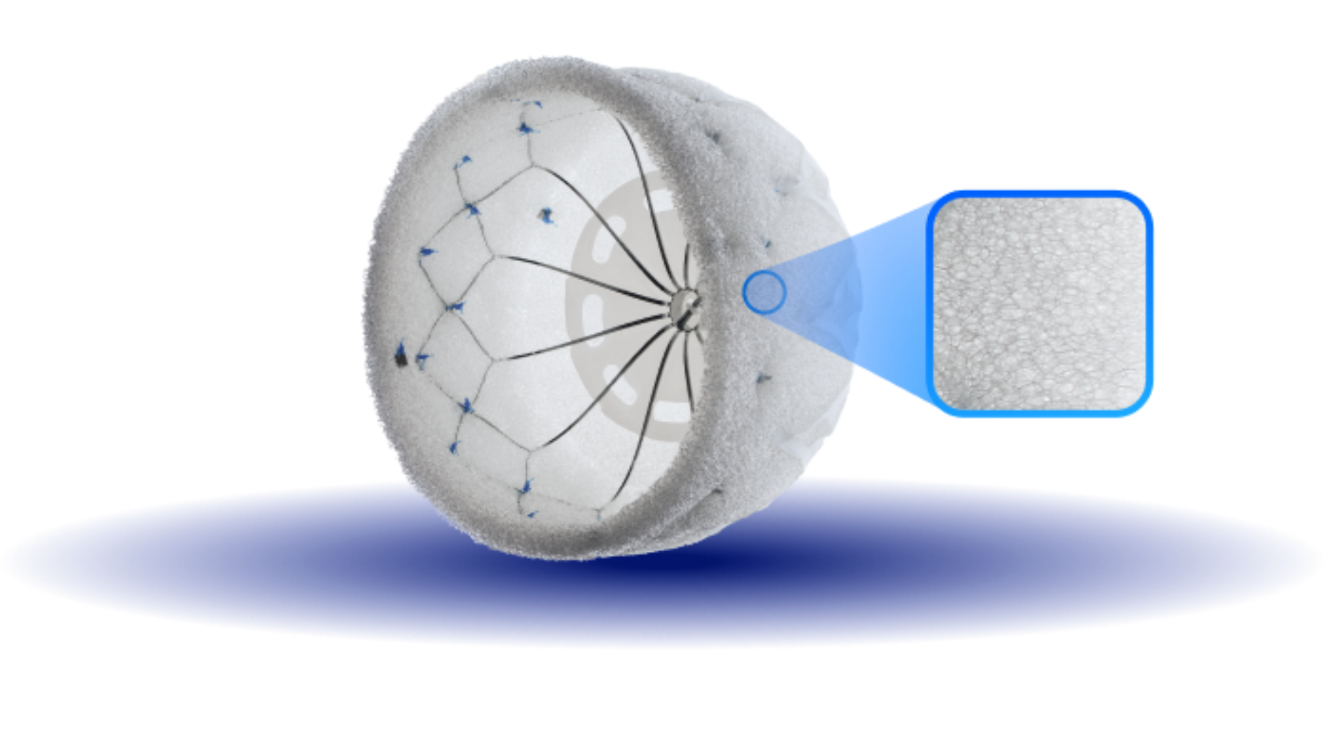 Conformal Medical cardiac device